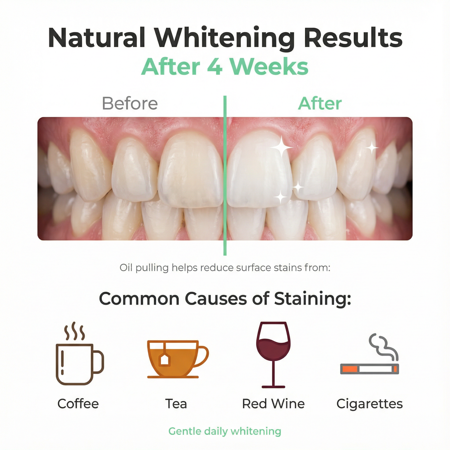 Pure Rinse™ Oil Pulling Treatment – Coconut & Mint